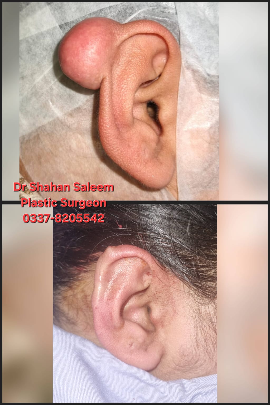 Before & After 52